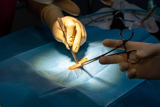 Minimally Invasive Spine Surgery: What You Need to Know